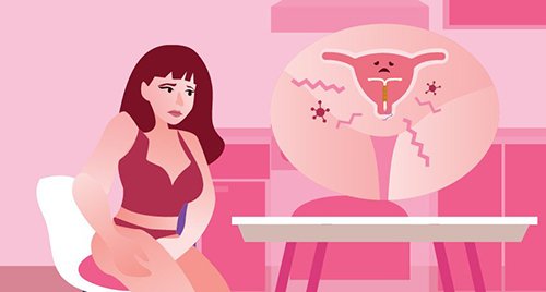 hết kinh bao lâu thì đặt vòng được? tác dụng phụ